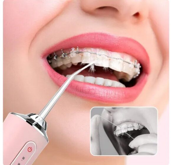 [NEW] Portable Dental Water Flosser, Travel Portable Dental Flosser with 4 Nozzles and 3 Modes, USB, 220ml, Rechargeable Dental Water Flosser, Water Pressure, Waterproof - Image 3