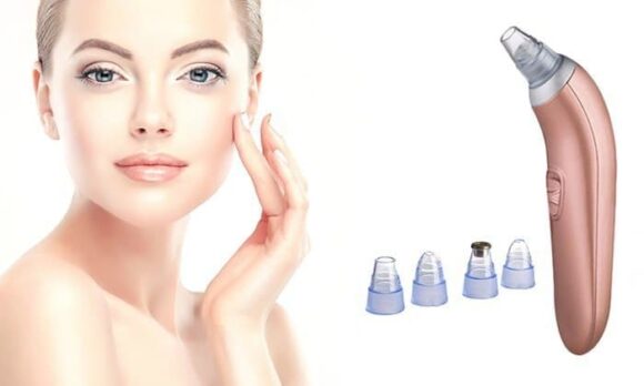 Acne Pore Vacuum Cleaner Beautiful Skin Care Expert Blackhead Remover - Image 3