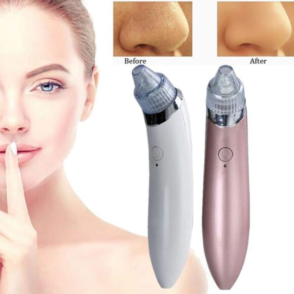 Acne Pore Vacuum Cleaner Beautiful Skin Care Expert Blackhead Remover - Image 2